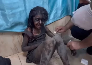 الاحتلال يستخدم أسلحة وذخائر محرمة دوليا ضد المدنيين فى غزة