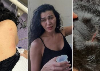 نادين الراسي تتعرض للضرب على يد شقيقها الأصغر