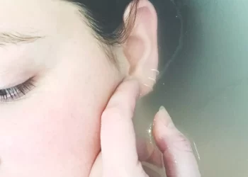 علماء يكتشفون أدلة جديدة حول “لغز الحكة” الذي طال غموضه