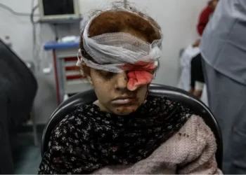 مشاهد مروعة من مجازر الاحتلال في رفح.. مأساة داخل المشافي