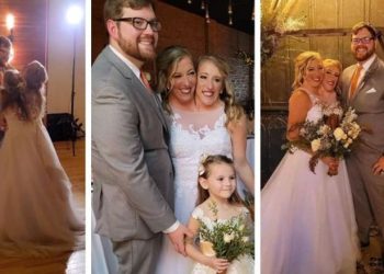 زواج «2 في 1».. قصة ارتباط التوأم الملتصق .. شاهد الصور