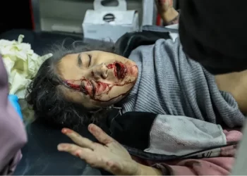 اليوم 161 للعدوان.. الاحتلال مستمر باستهداف منتظري المساعدات