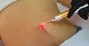 مداهمة شقة سكنية في عمان تجرى داخلها عمليات تجميلية باستخدام حقن غير مجازة