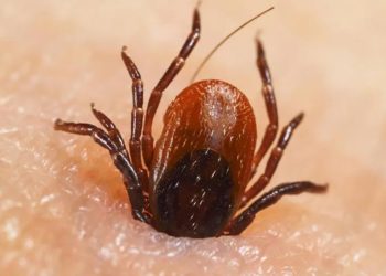 وفاة شابة أردنية بعد غيبوبة 19 يوماً إثر لدغة حشرة “القراد”