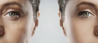 6 أطعمة “تفوق البوتوكس” في محاربة الشيخوخة وتجديد شباب البشرة