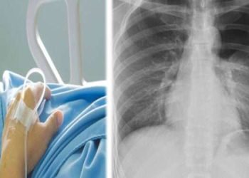 نجل رئيس وزراء أسبق في العناية الحثيثية و الأطباء يكسرون له (ضلعين) لإنعاشه