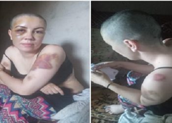 مواطن سعودي يعذب زوجته المغربية ويحلق رأسها